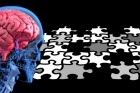 Esquecimento coletivo ou Alzheimer?