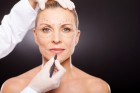 Face lift: resultados naturais e mais duradouros