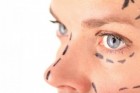 Até onde é possível melhorar com uma cirurgia plástica