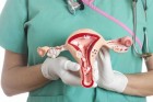 Ginástica íntima para a saúde da mulher