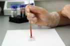 Novembro Azul ressalta a importância da prevenção do câncer de próstata